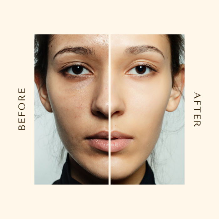 Before After Potato face wash with chamomile for skin lightning and dark spot removal